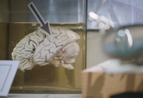 무터박물관에 보관된 아인슈타인의 뇌. [사진=도서출판 한빛비즈] 